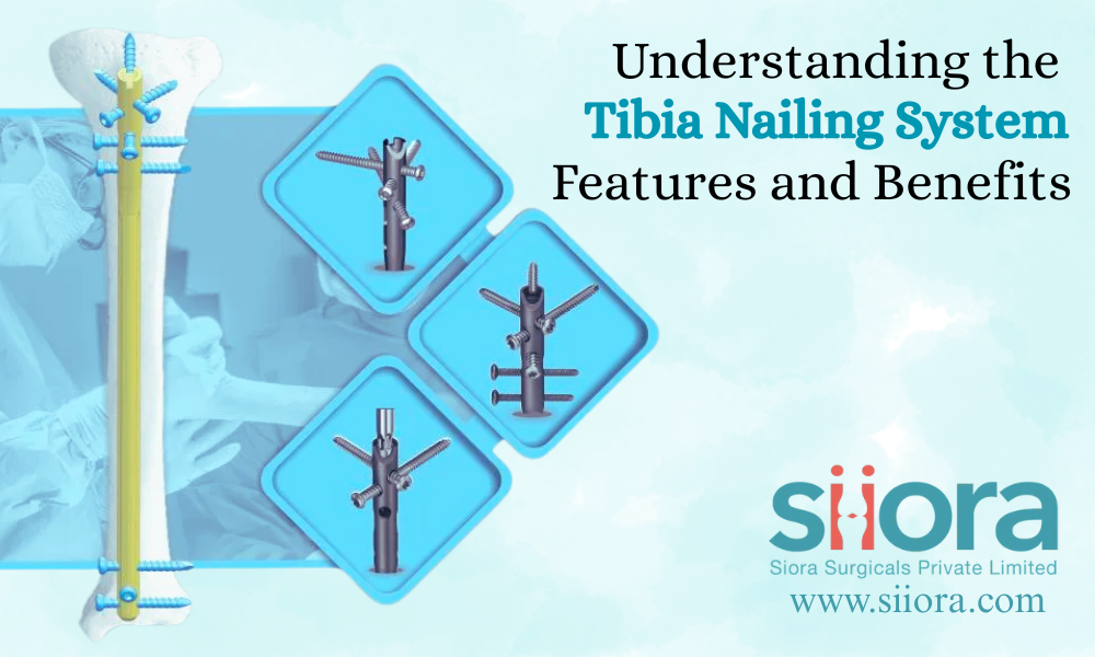 Understanding the Tibia Nailing System: Features and Benefits